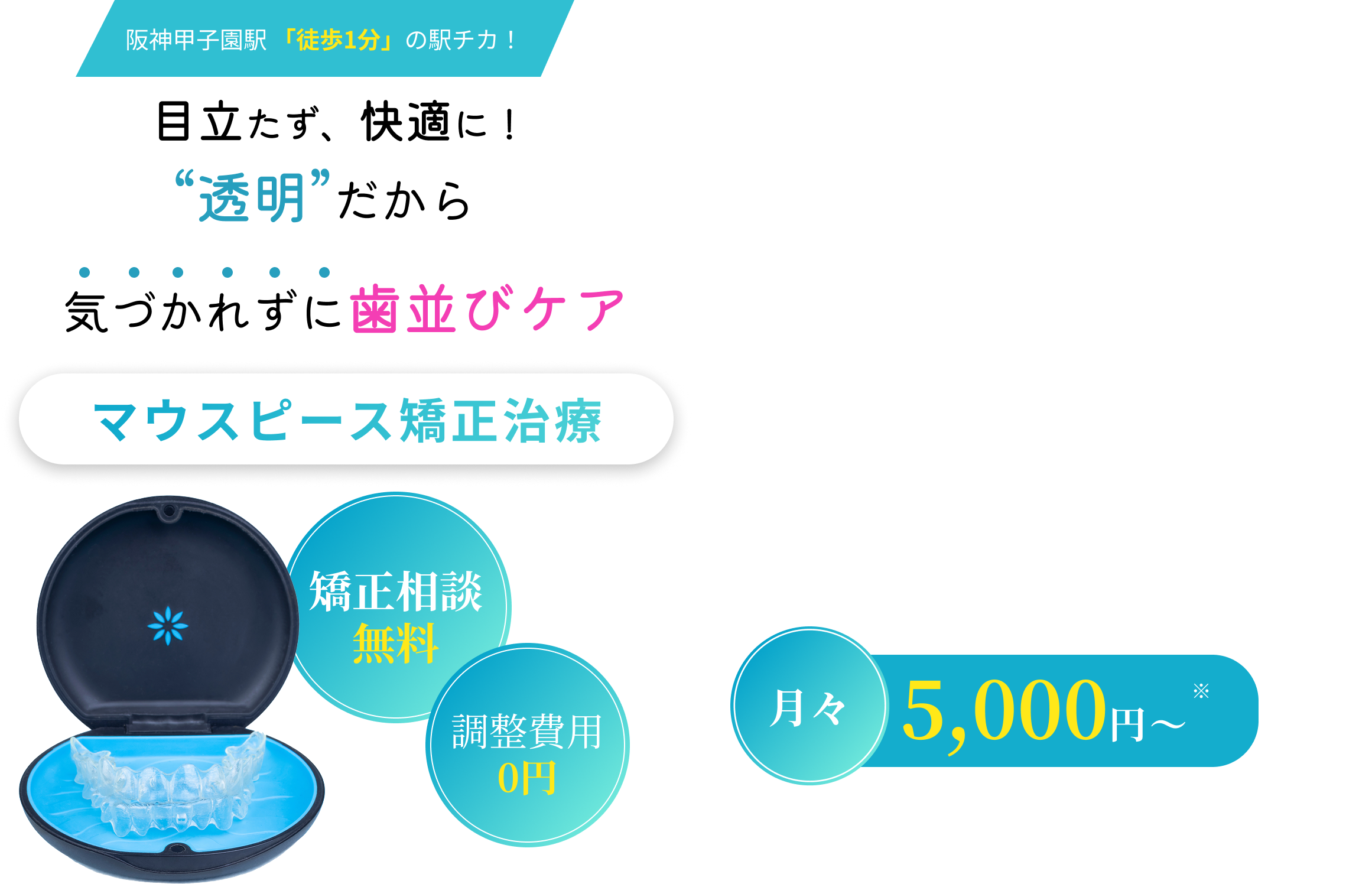 阪神甲子園駅徒歩1分・和手歯科医院のマウスピース矯正治療