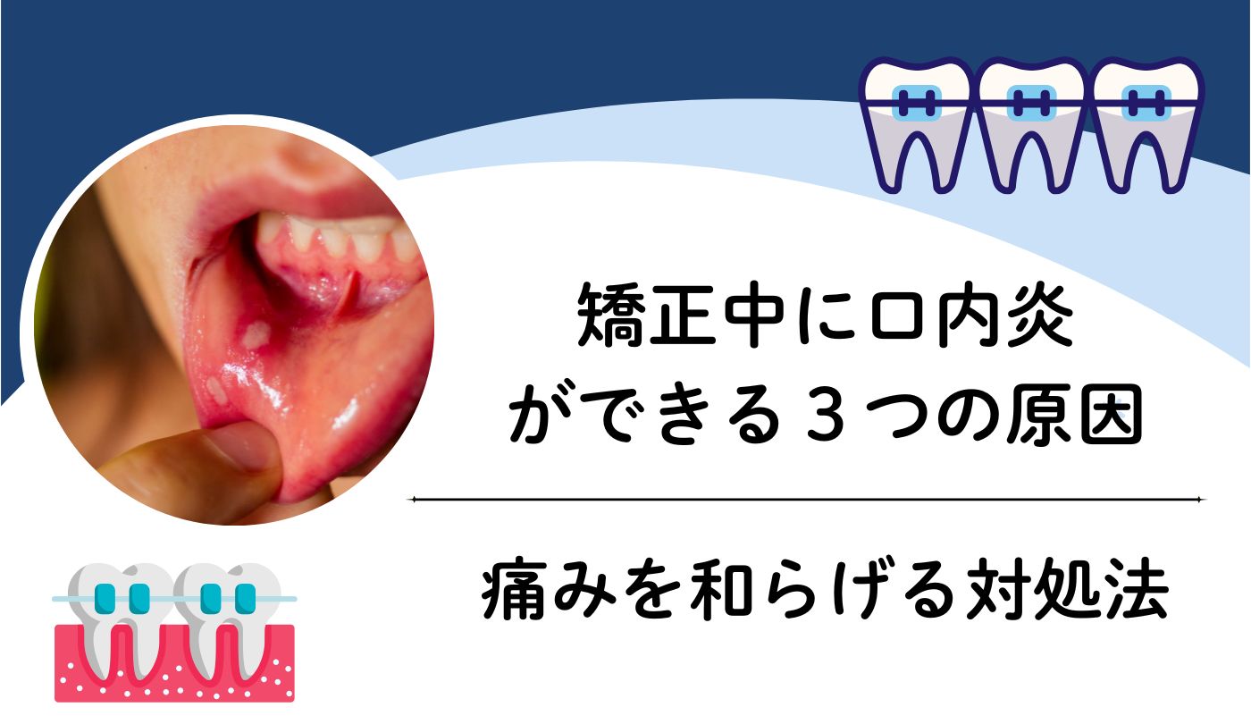 矯正　口内炎　痛み　対処法　原因