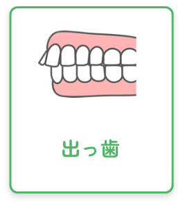 出っ歯