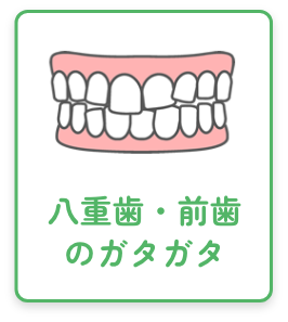 八重歯・前歯のガタガタ