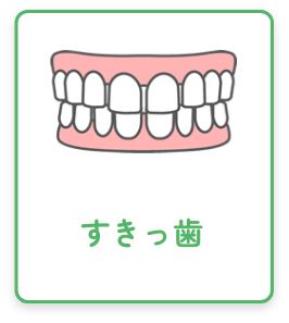 すきっ歯