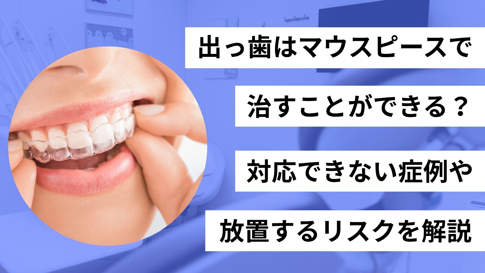 出っ歯　矯正　マウスピース