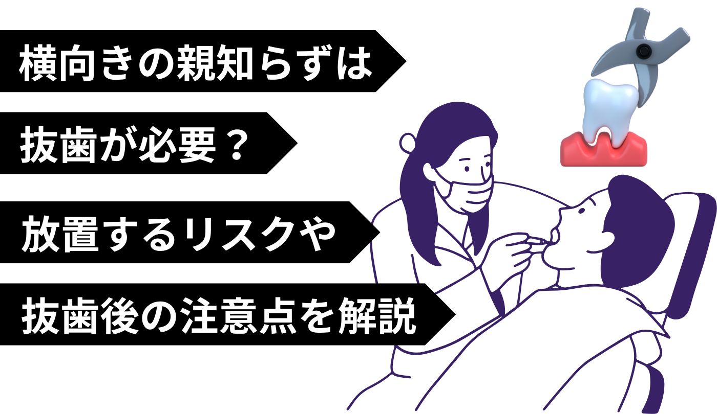 親知らず　横向き　抜歯