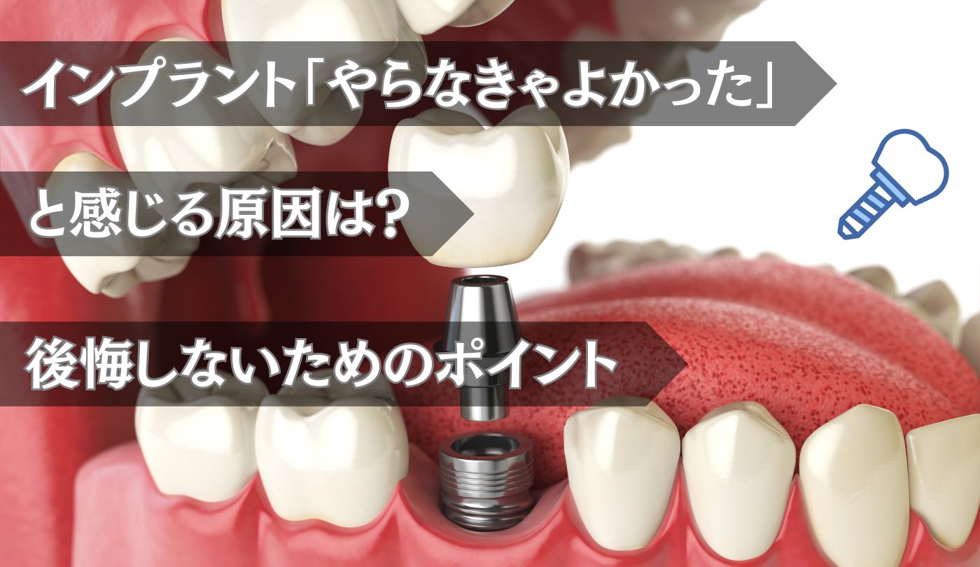 インプラント　やらなきゃよかった