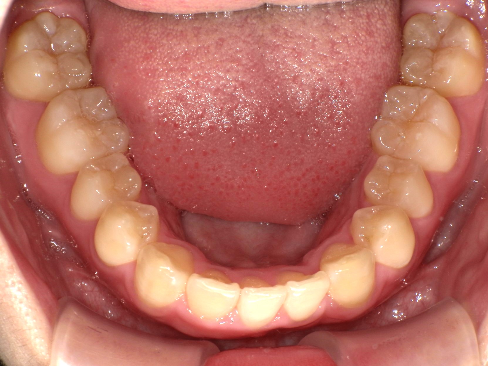 After